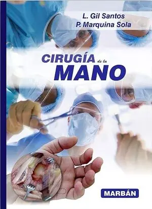 CIRUGIA DE LA MANO Liquidación